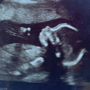 Meet your Posher, Hanna